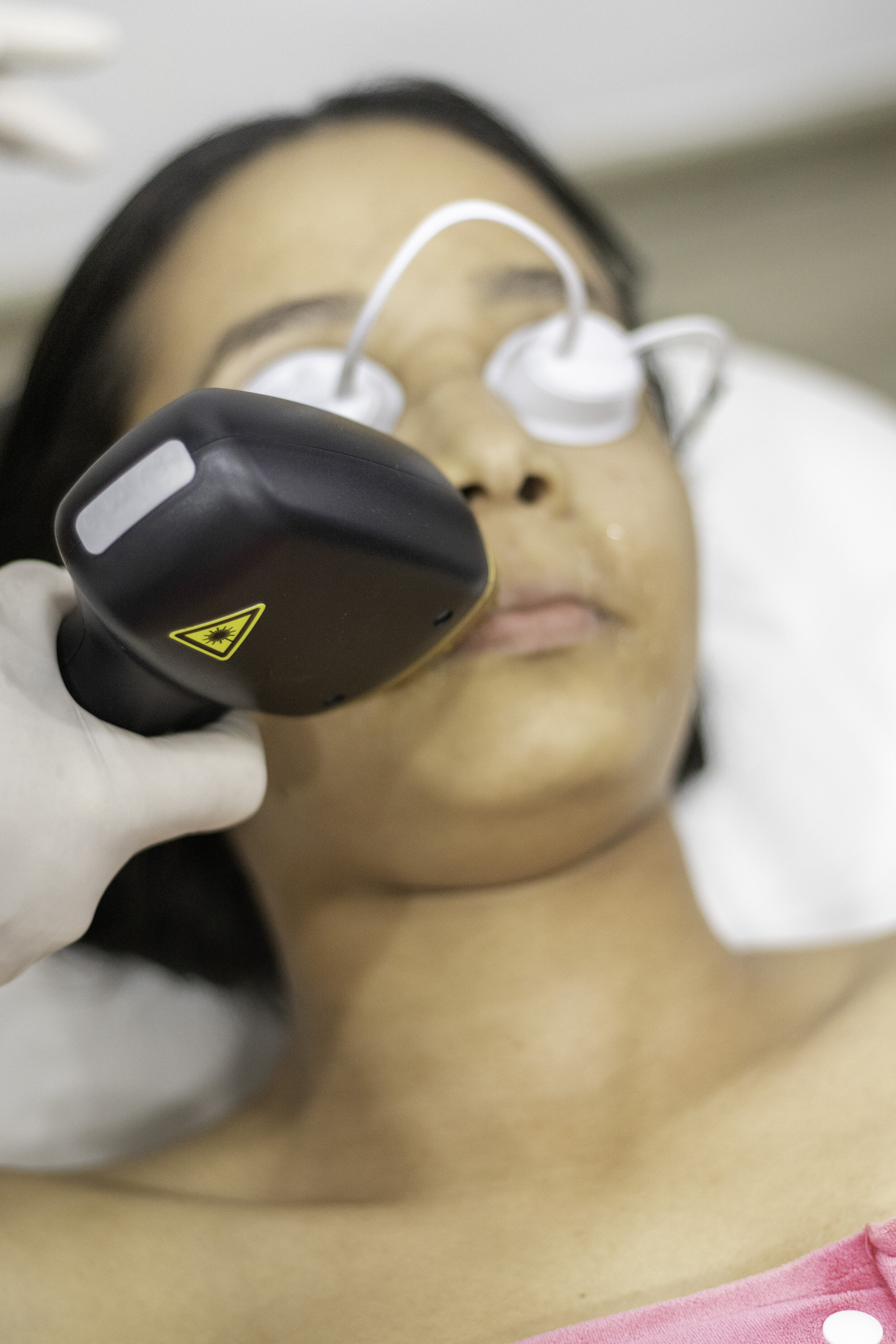 Cuándo evitar la depilación láser? — Relief Dermatología y Estética