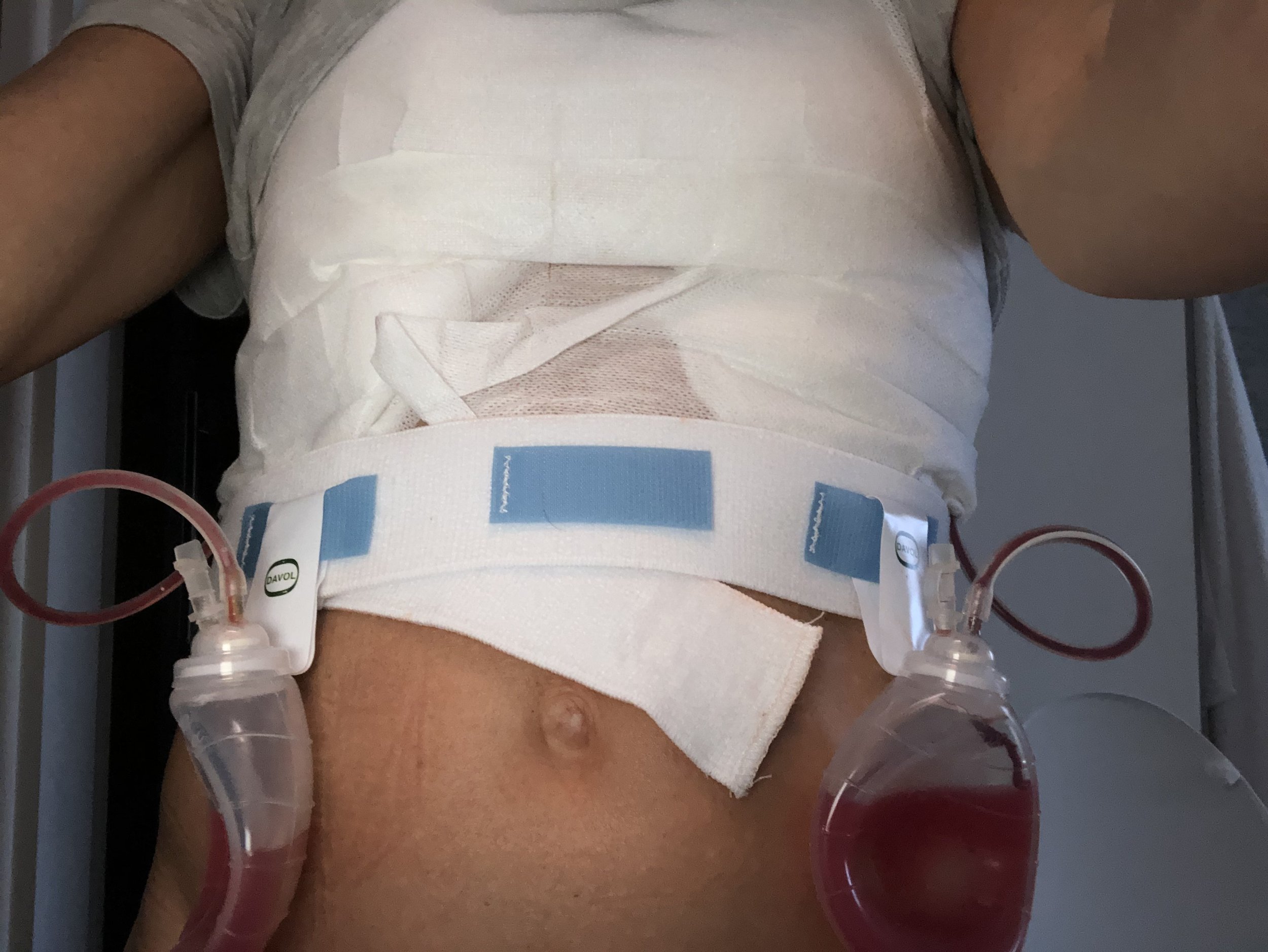Conventional Treatment — Cancer ToDo List