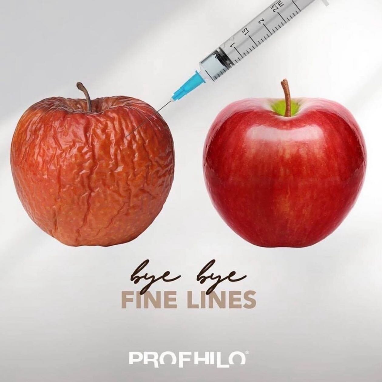 Say hi 👋 to a healthier and softer looking skin! The treatment with Profhilo improves skin tone, texture, hydration and overall radiance. It can help to increase firmness and elasticity and promote healthier and softer-looking skin. 

👉Profhilo is 