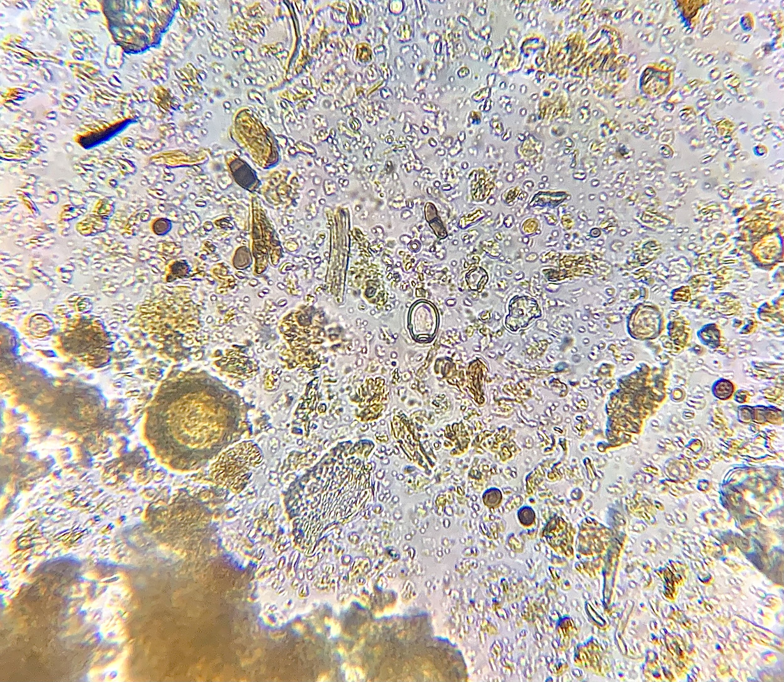 Microbes in compost .jpeg