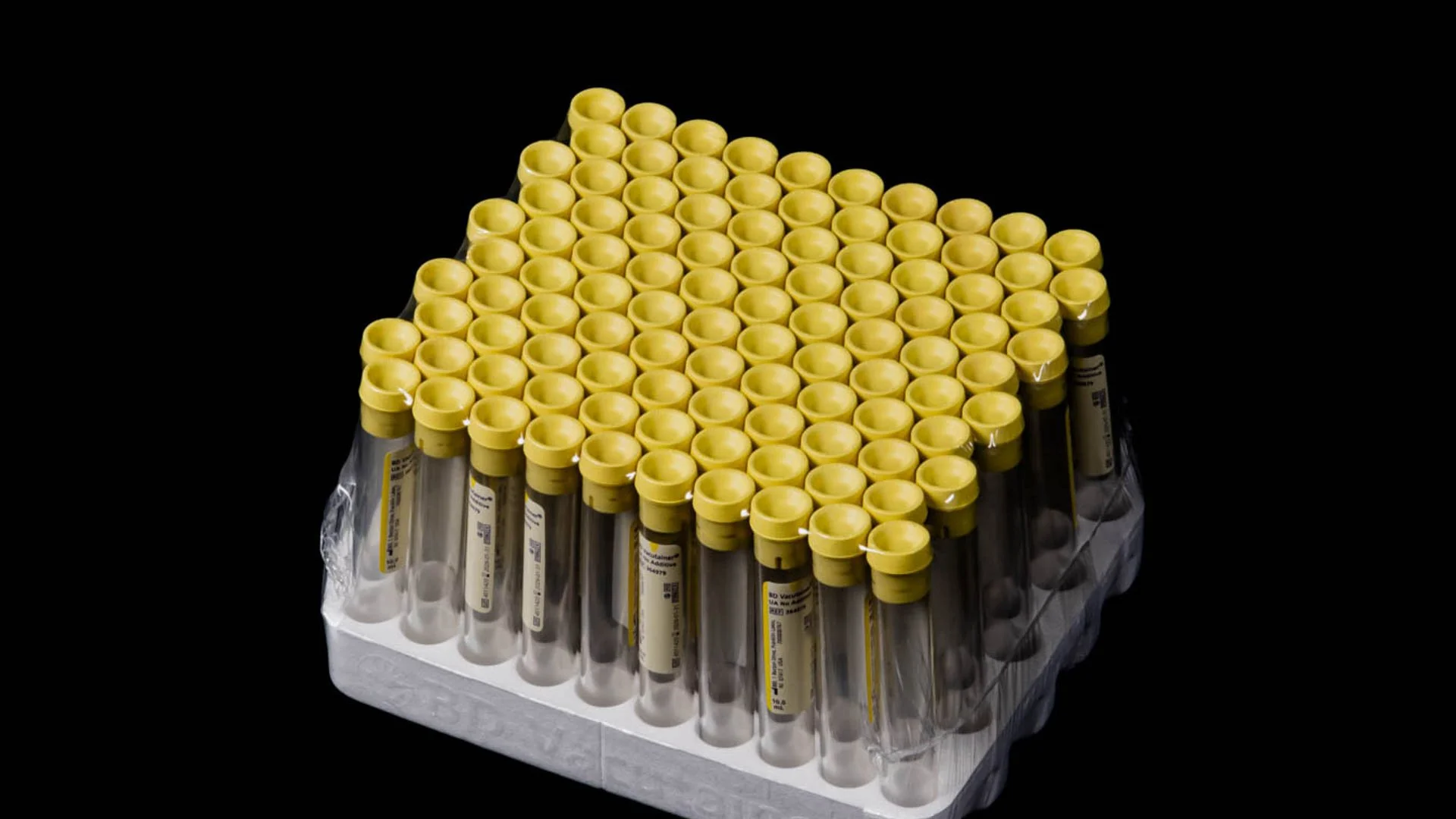 bd_urine_1920x1080.jpg