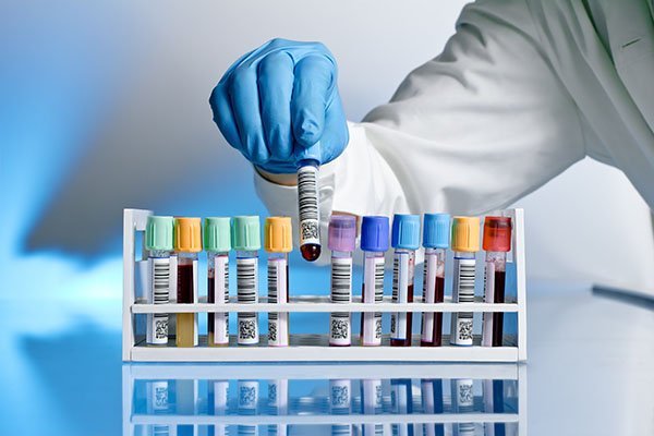 Types Of Vacutainer Needles