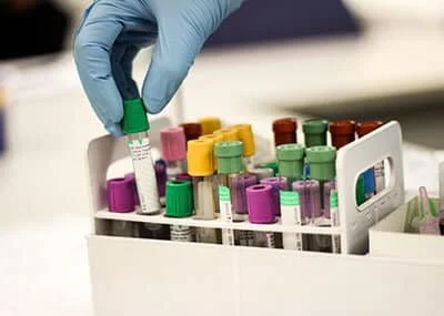 Needle Technology For Difficult Veins In Pediatrics