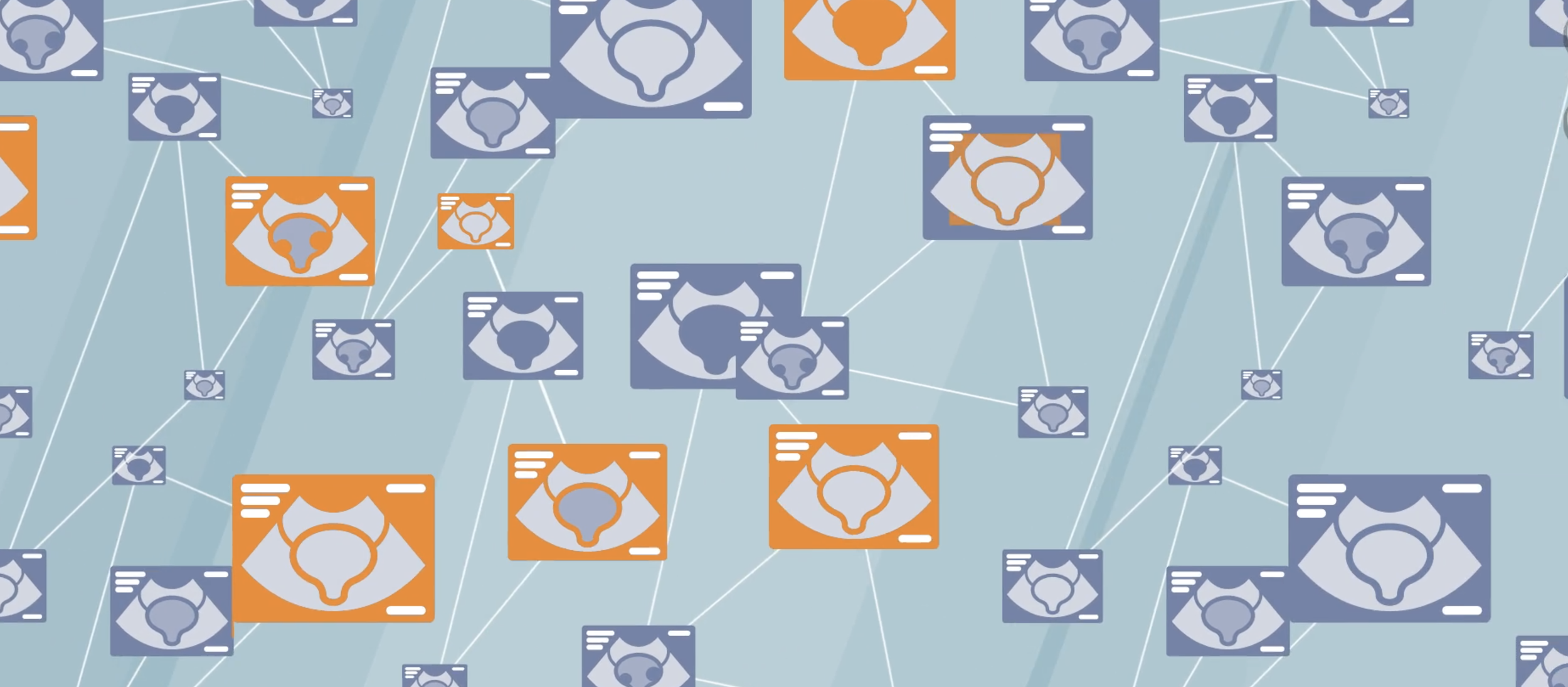 EchoNous Ai-driven Ultrasound