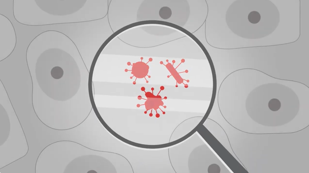 Three cancer cells under a magnifying glass