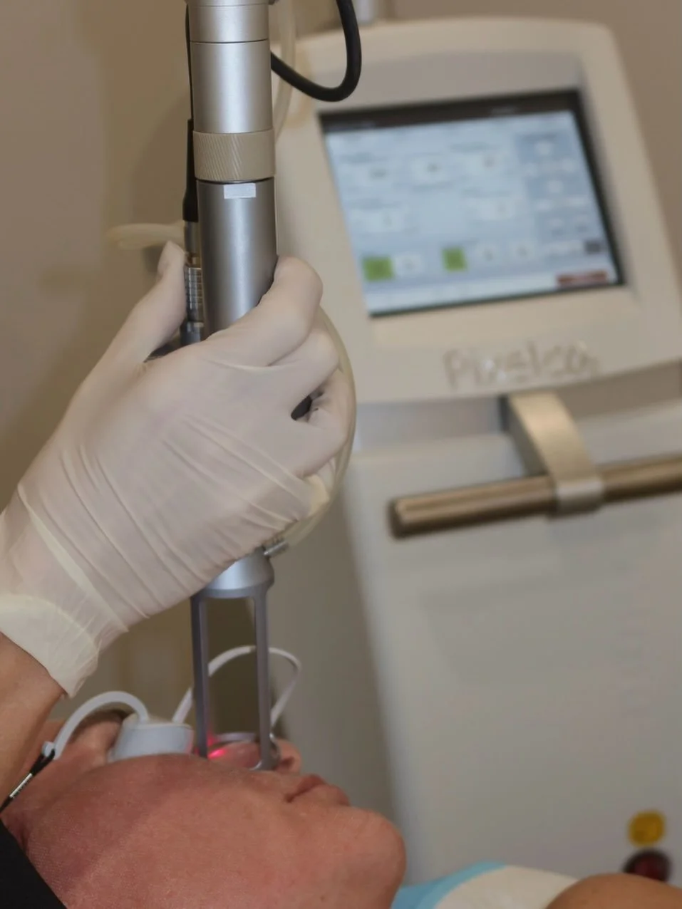 The difference between Co2 Laser Facial and Co2 Laser Resurfacing&hellip;.

Co2 facial is a light fractional treatment which targets the top layer of the skin whilst delivering heat deeper to promote collagen production. Ideal for improving skin text