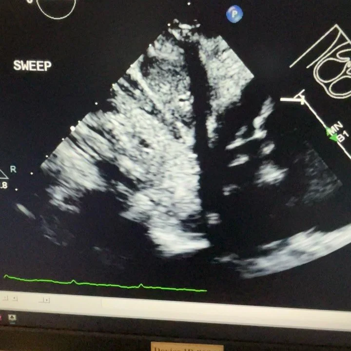 Gooooood morning and Happy #WorldHeartDay ladies n gents 🫀🌎🫀🌍🫀🌏🫀 

I took a break from managing social media and spreading medical memery on your algorithm the other day and I actually scanned a patient (cuz that&rsquo;s my real job and this i
