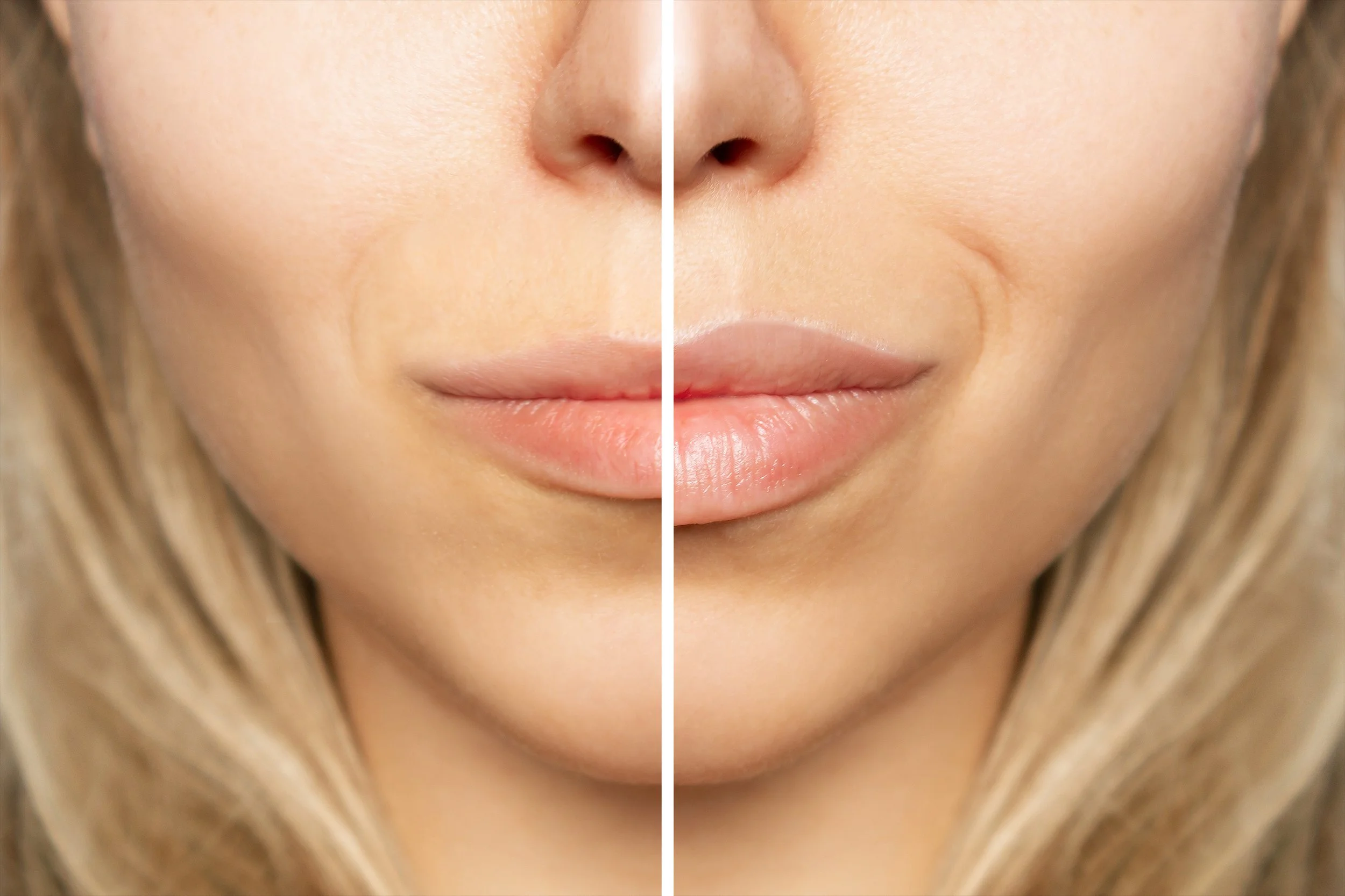 Do Lip Plumper Glosses Actually Work? Why Choose Lip Flip or Filler Instead