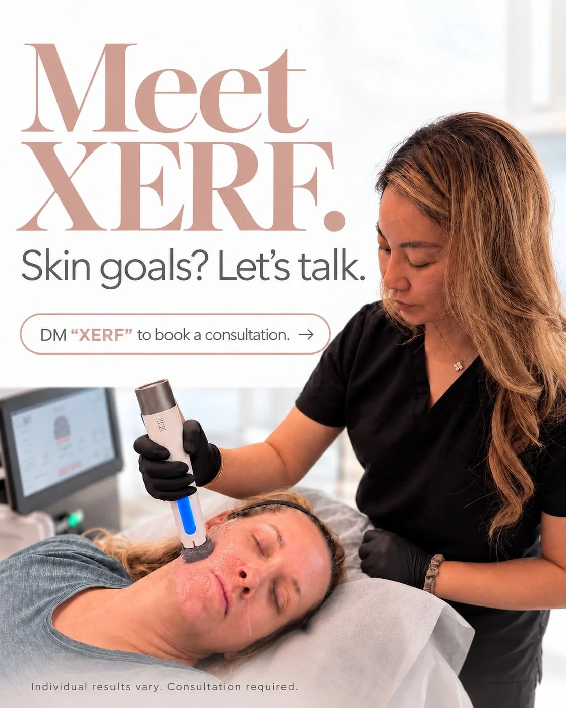 Meet XERF&mdash;a new chapter in skin tightening at Beauty Cult.

Curious whether it&rsquo;s right for you? Let&rsquo;s start with your skin goals and a personalized consultation.

DM &ldquo;XERF&rdquo; to learn more or book with Dr. Clara Yu.

Indiv