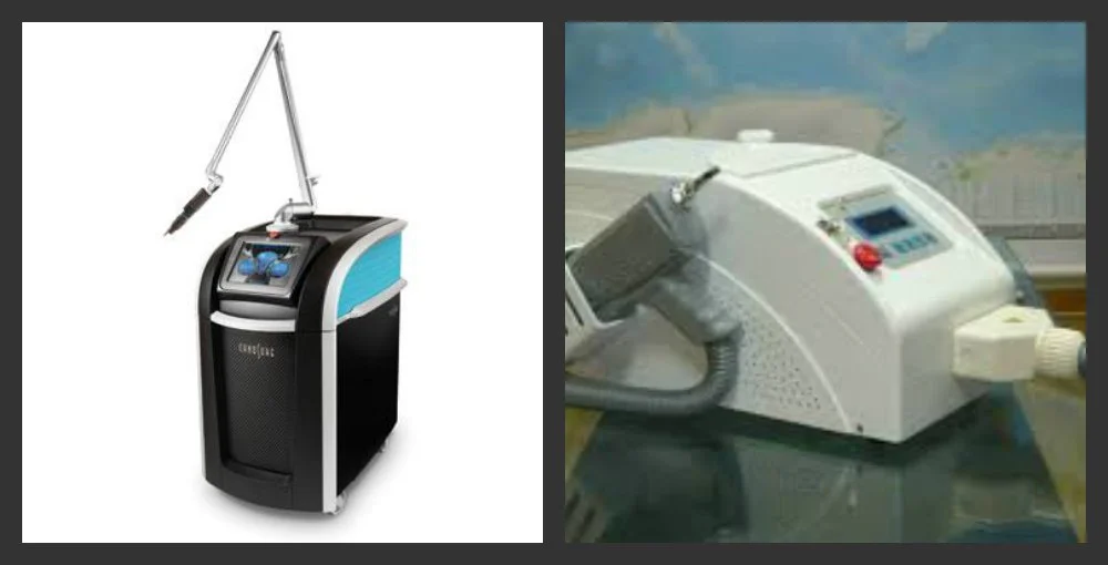 Pico Laser vs. Q-Switched Laser for Pigmentation Treatment — Clarion