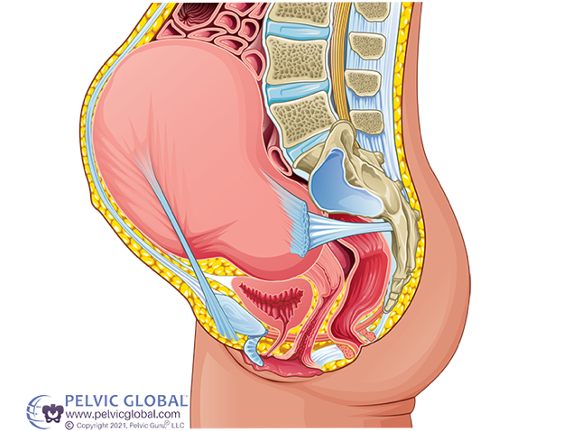 Round ligament pain in pregnancy