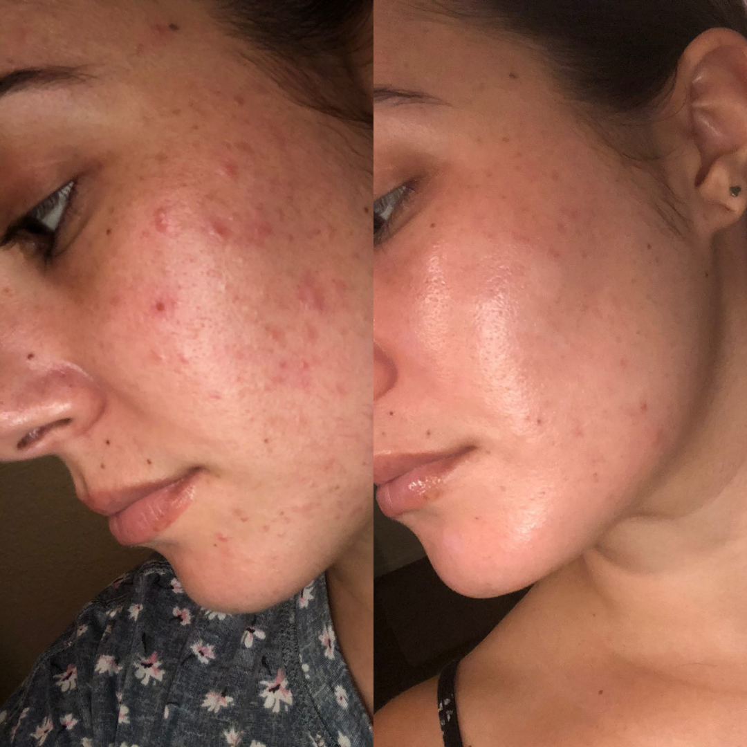 The Skin Suite by Kristin Roseville California Facials and Skincare