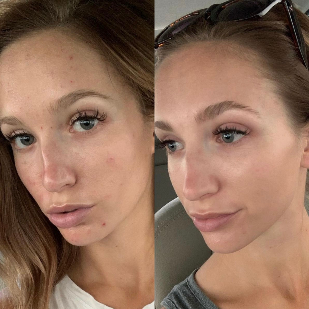 The Skin Suite by Kristin Roseville California Facials and Skincare