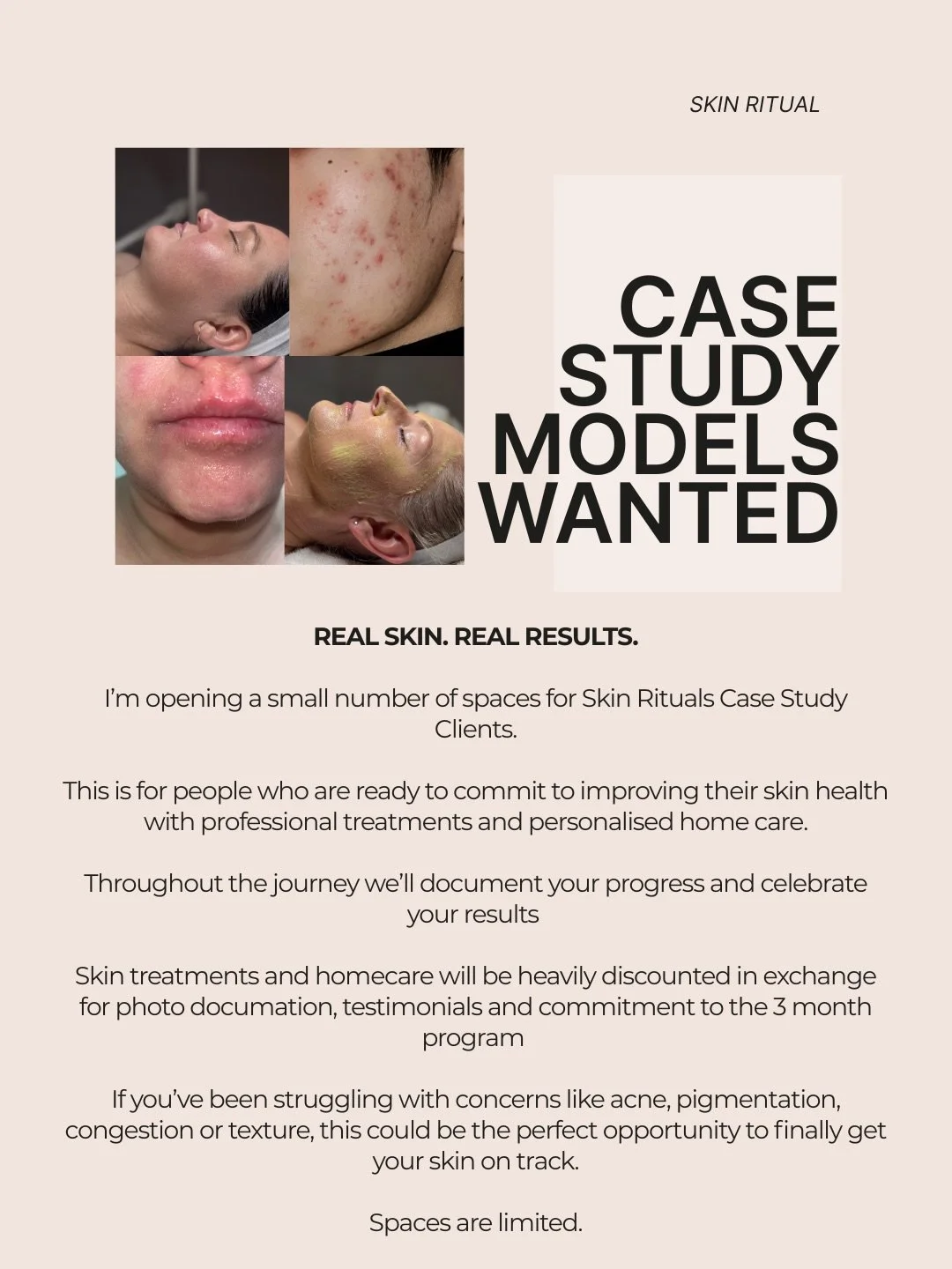 I&rsquo;m opening a few spaces for something a little special at Skin Ritual!

I&rsquo;m looking for a small number of clients who are ready to commit to their skin journey and allow me to document the process along the way.

If you&rsquo;ve been fee