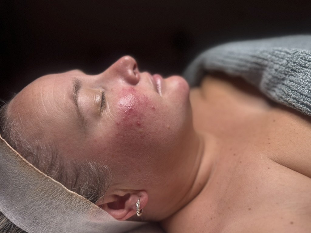 Jess's Story: Calmer Skin, Less Redness, and a Stronger Barrier in 12 Weeks