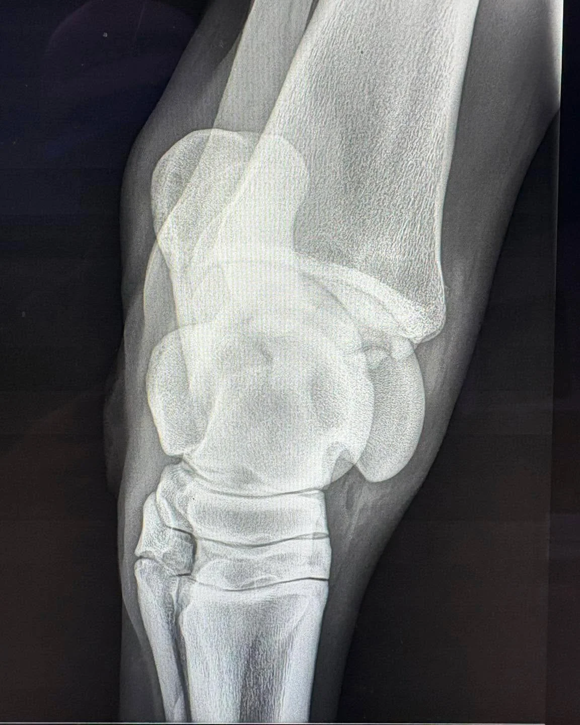 Can anyone spot the problem here???🤔🤔

Hint: 3yr old presenting with a swollen hock 

Put your guesses down in the comments below 👇 

If your horse is presenting with strange swelling, contact us to discuss your options 

☎️ 0491 932 333
🌐 www.eq