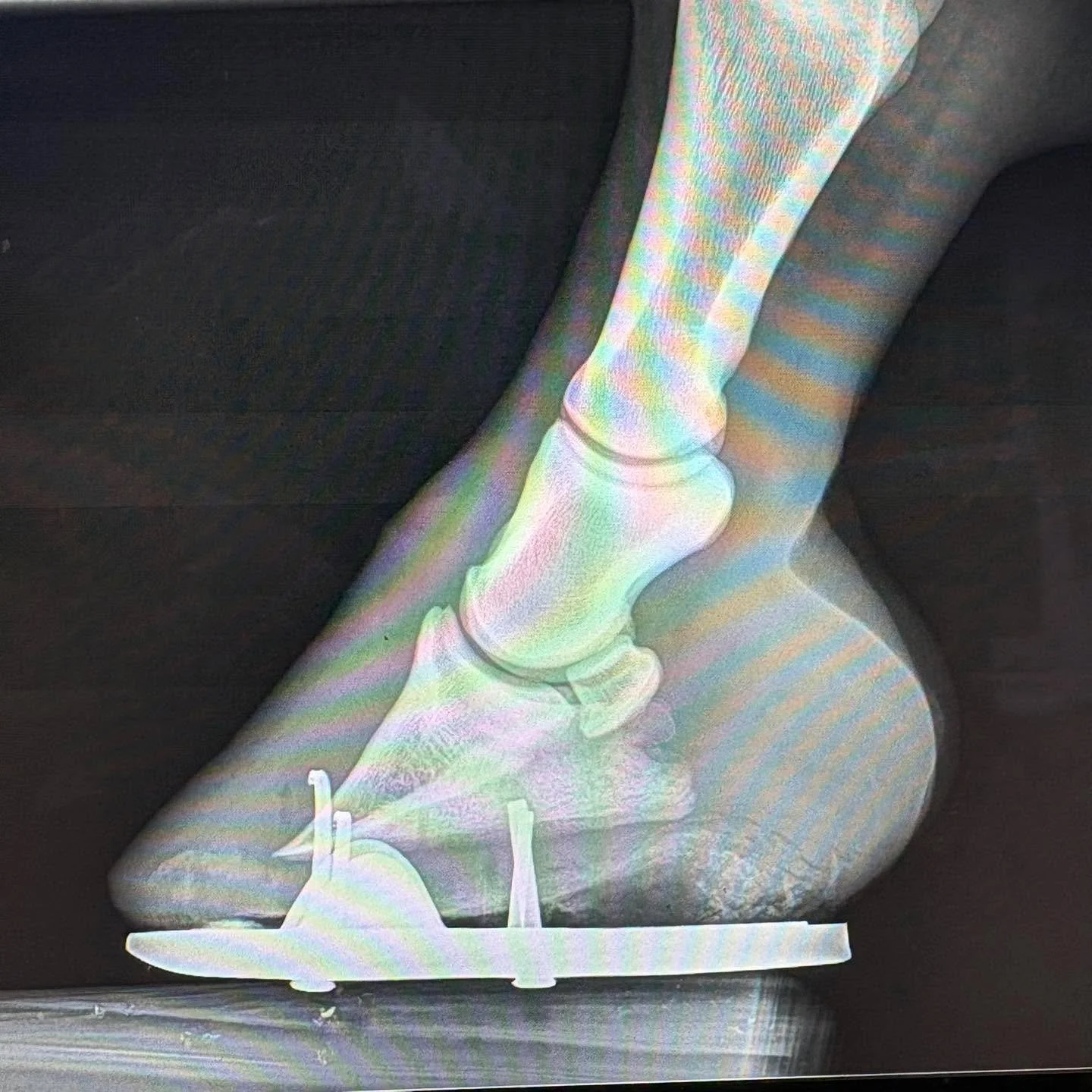 Do you have x-ray vision to know what&rsquo;s going on in your horses hooves?

📐The slightest angle off can change the whole balance of a horses hoof

🩻X-rays are a great tool to use to help your farrier do the best job they can to have the perfect