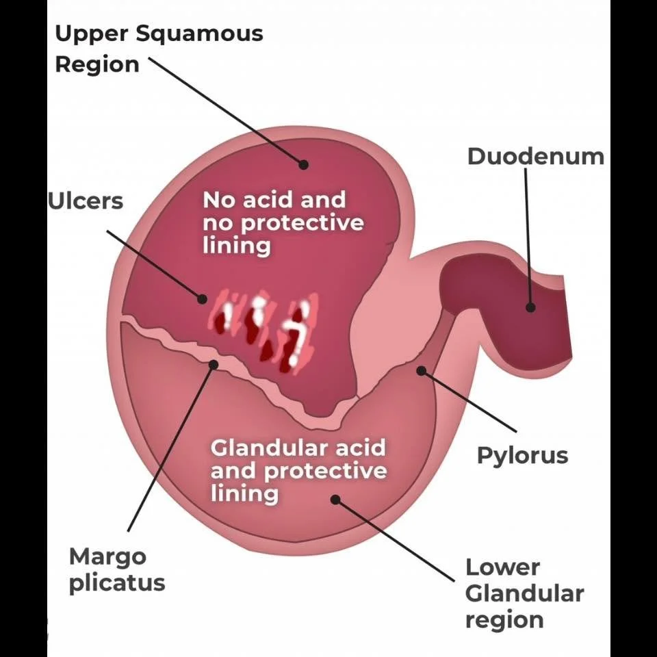💭DID YOU KNOW💭

‼️There are 2 types of stomach ulcers in horses‼️
With different types of ulcers comes different treatment and management plans

🔎Squamous Ulcers (ESGD): Affects the upper (non-glandular) portion of the stomach. This area lacks a p