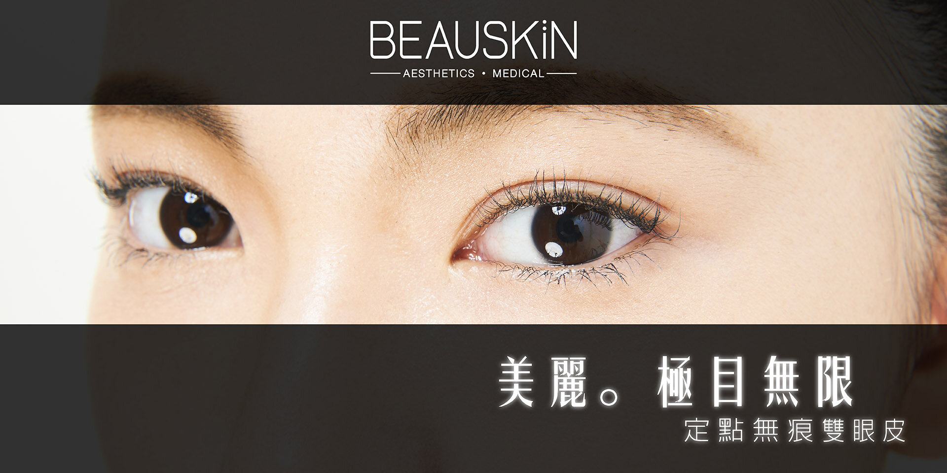 雙眼皮-14800-r2_1920x960-r2.jpg