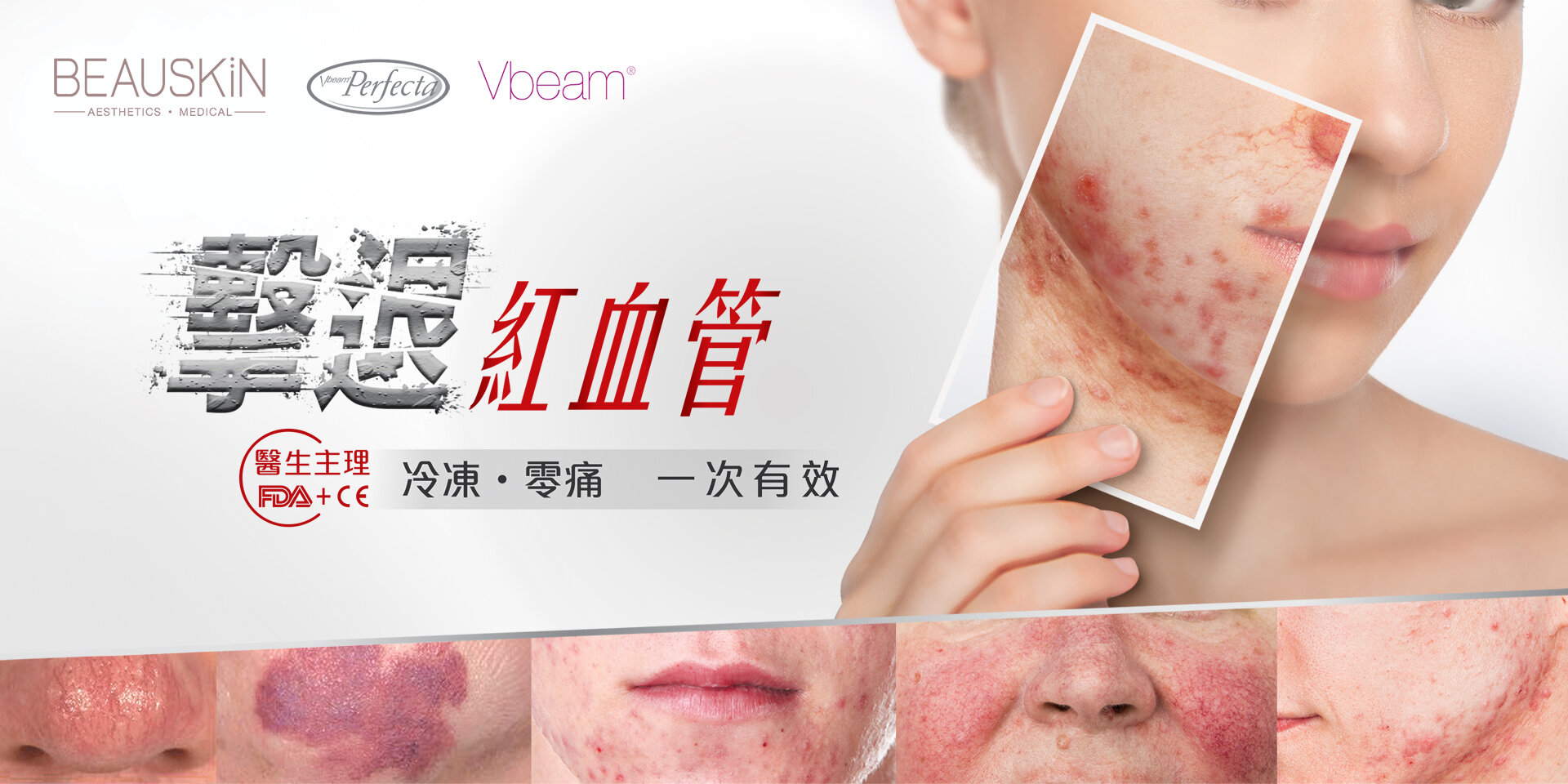 VBeam-facebook.jpg