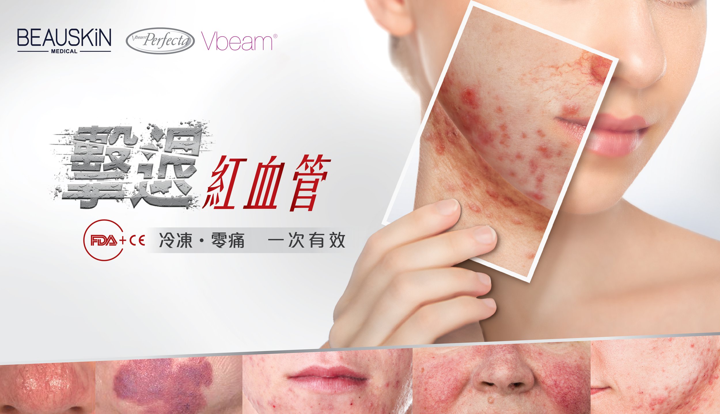 FB_VBeam_promo-20251210.jpg