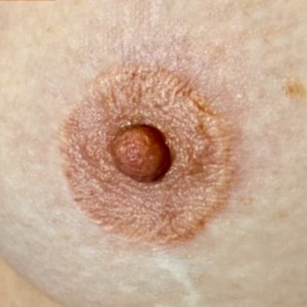 EXAMPLE 1 AFTER: Photo taken same day as tattooing with color correction and depth, restoring the look of the. areola and nipple.