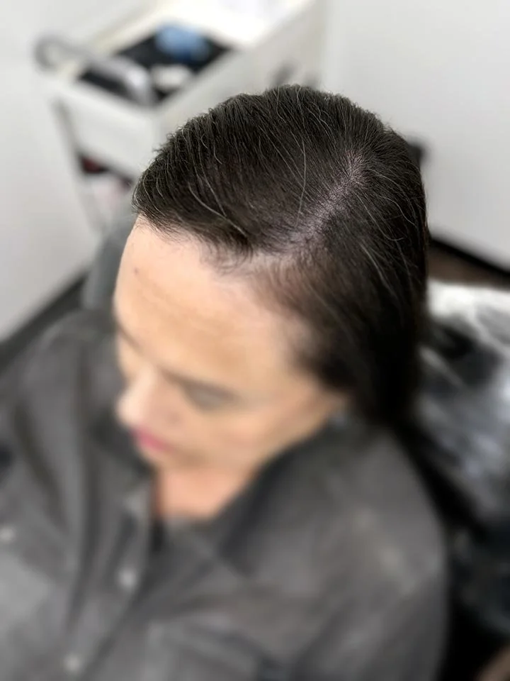 Scalp Micropigmentation for Women San Diego