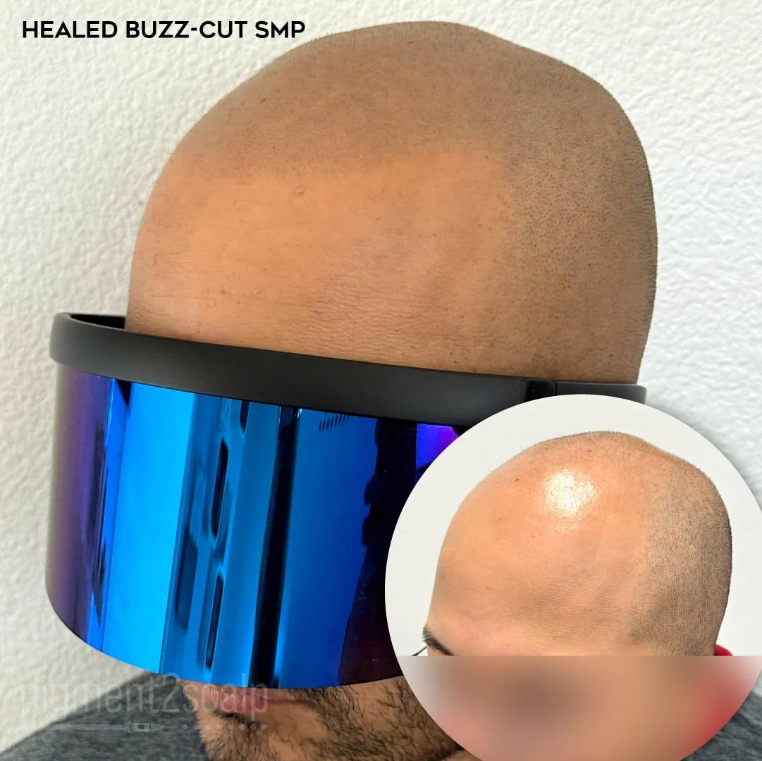 smp-san-diego-scalp-micropigmentation-healed-72dp-02_SMP.jpg