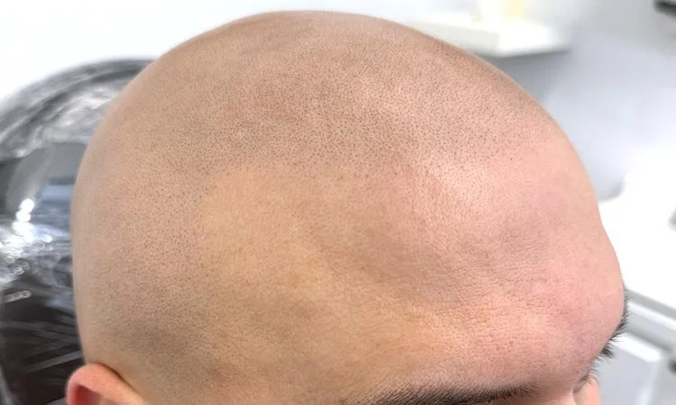 How to Choose the Right SMP Artist for a Buzz Cut or Shaved Head Look