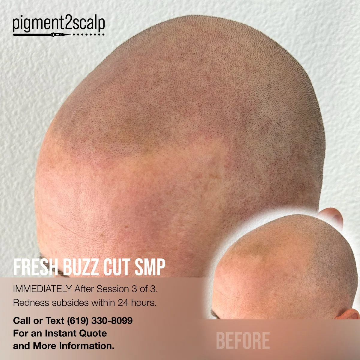 fresh buzz cut smp before after scalp micropigmentation session