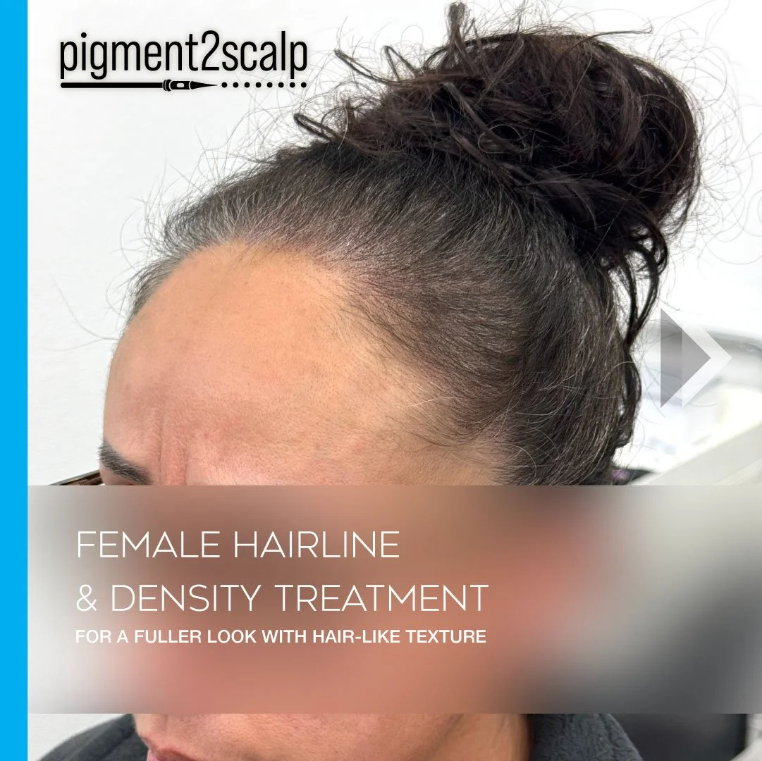 Female_smp-Density_Fill_Thinning_Hair_san-diego-72dpi-01.jpg