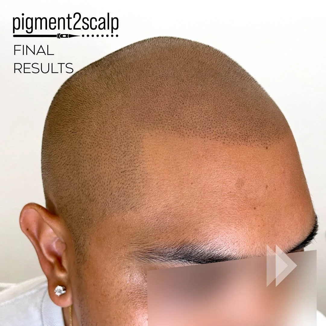 number1-smp-san-diego-hair-tattoo-site-03.jpg