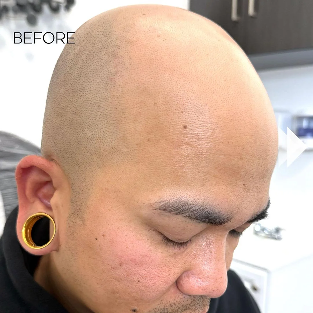 smp-san-diego-hairLINE-tattoo-DF-02-72dpi.jpg