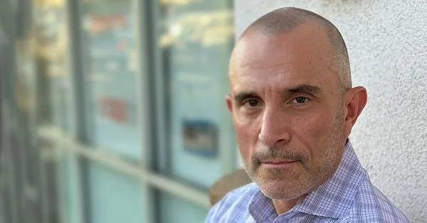 san diego realistic looking smp scalp micropigmentation