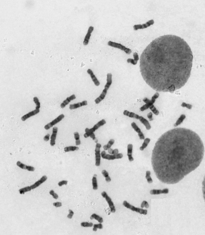 Human G-Band metapase without outlier