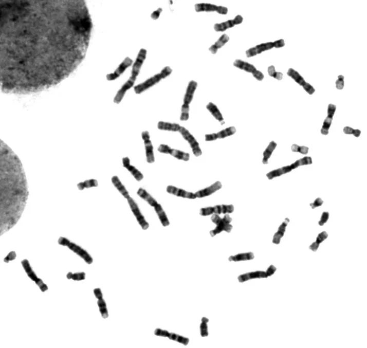 Human G-banded metaphase 2