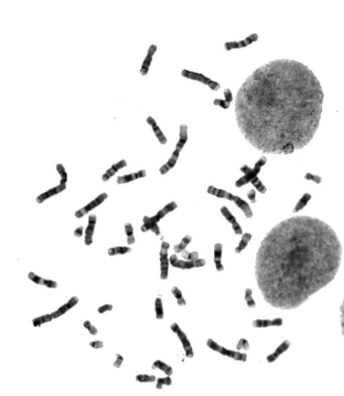 Human G-banded metaphase 1