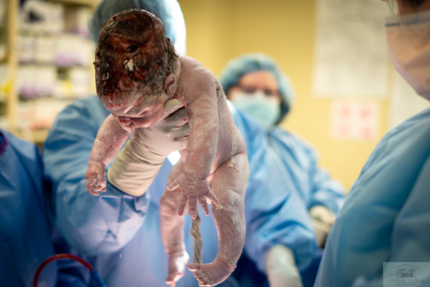  Edgar Hawk takes his first breath as he is delivered via C-section. Christopher snapped this photo in the operating room. 