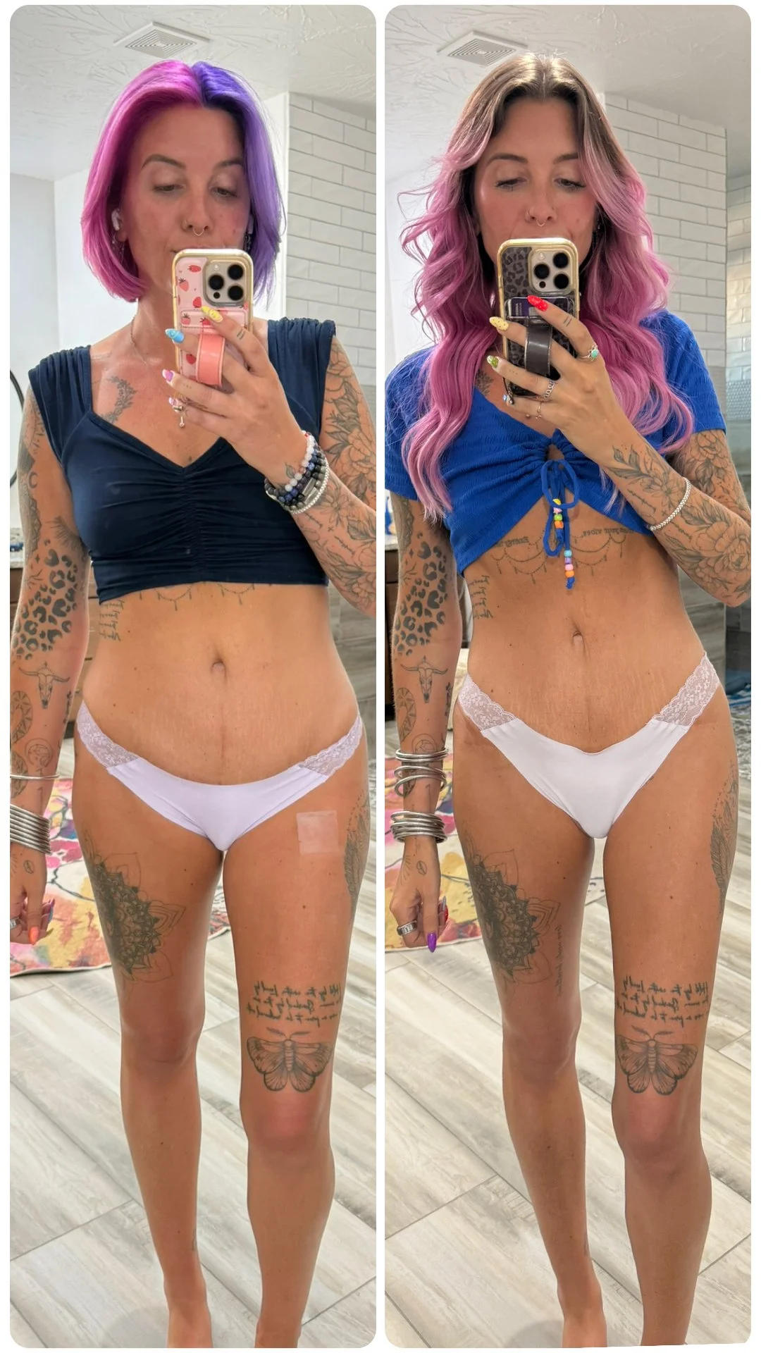 Before and after frontal comparison
