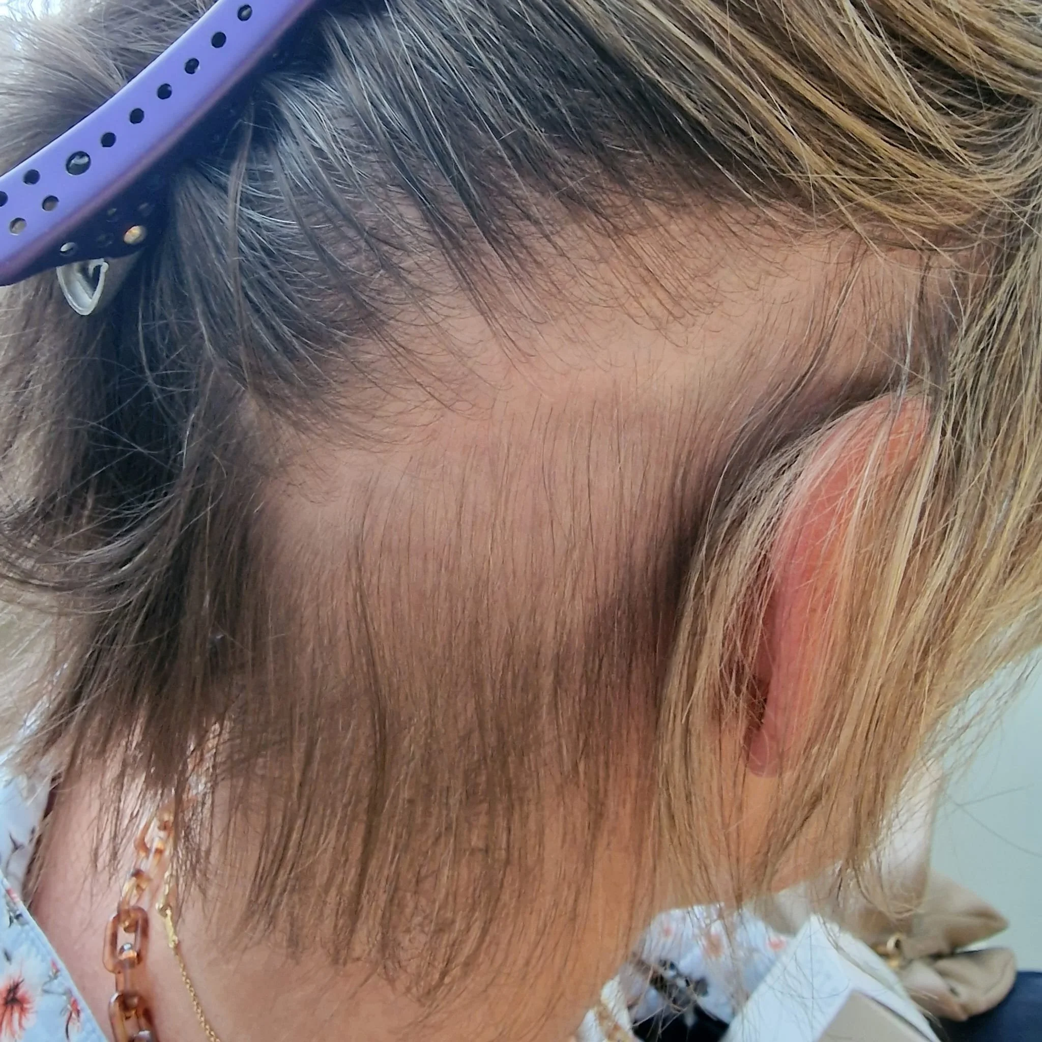 Roots professional UK