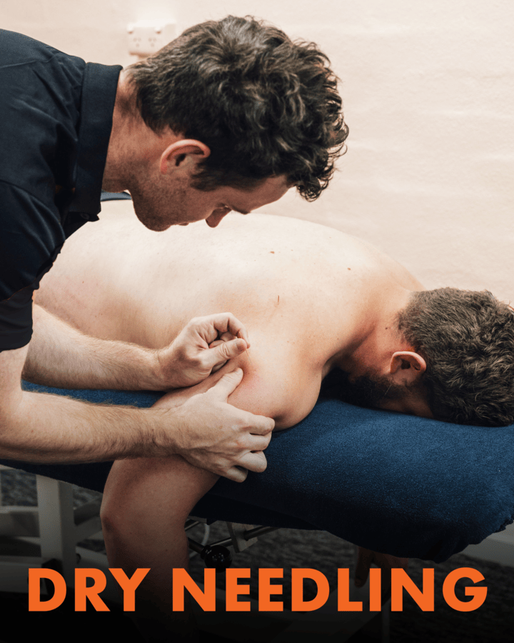 What is Dry Needling?