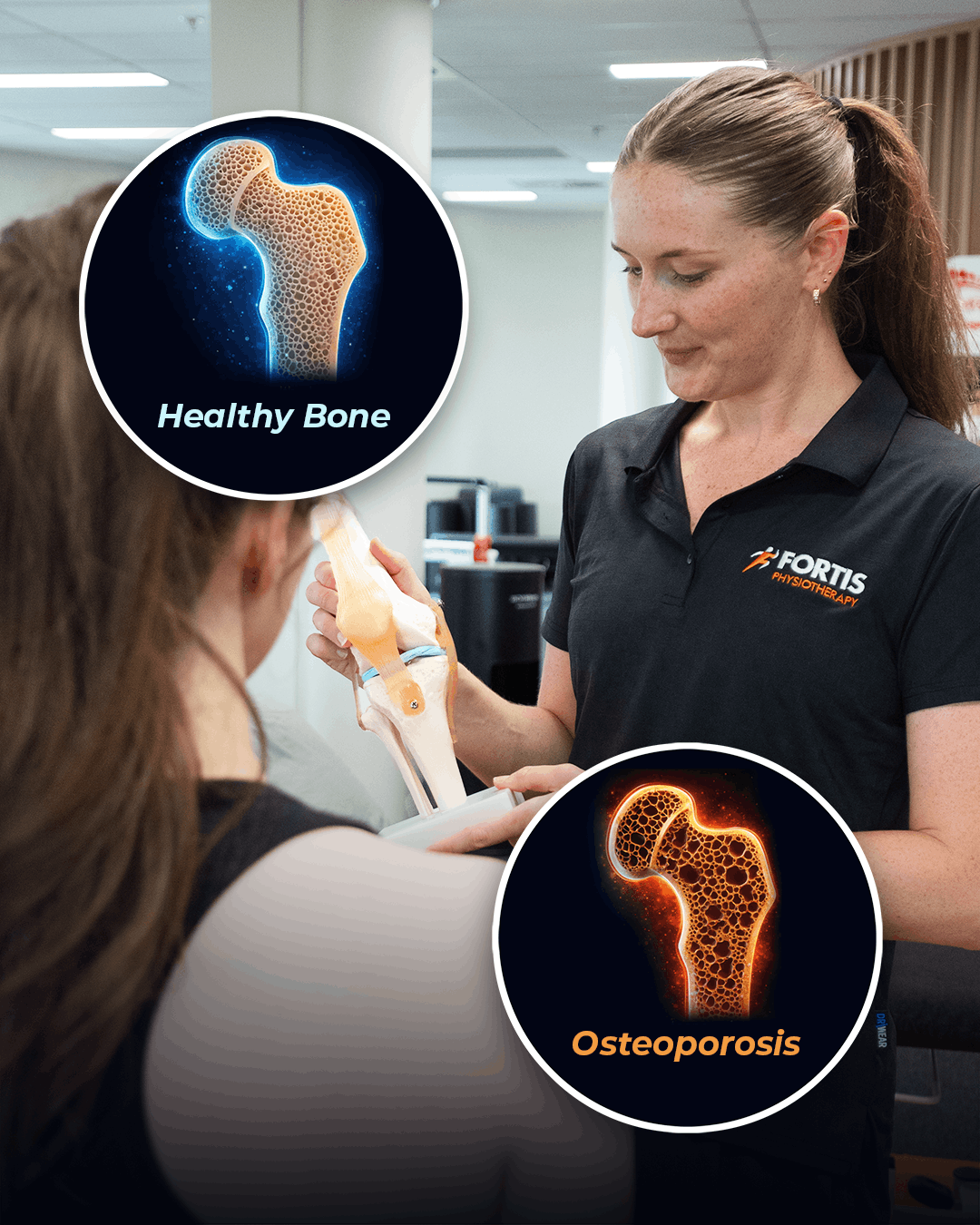 Building Better Bones - Bone Health and How it can Affect You