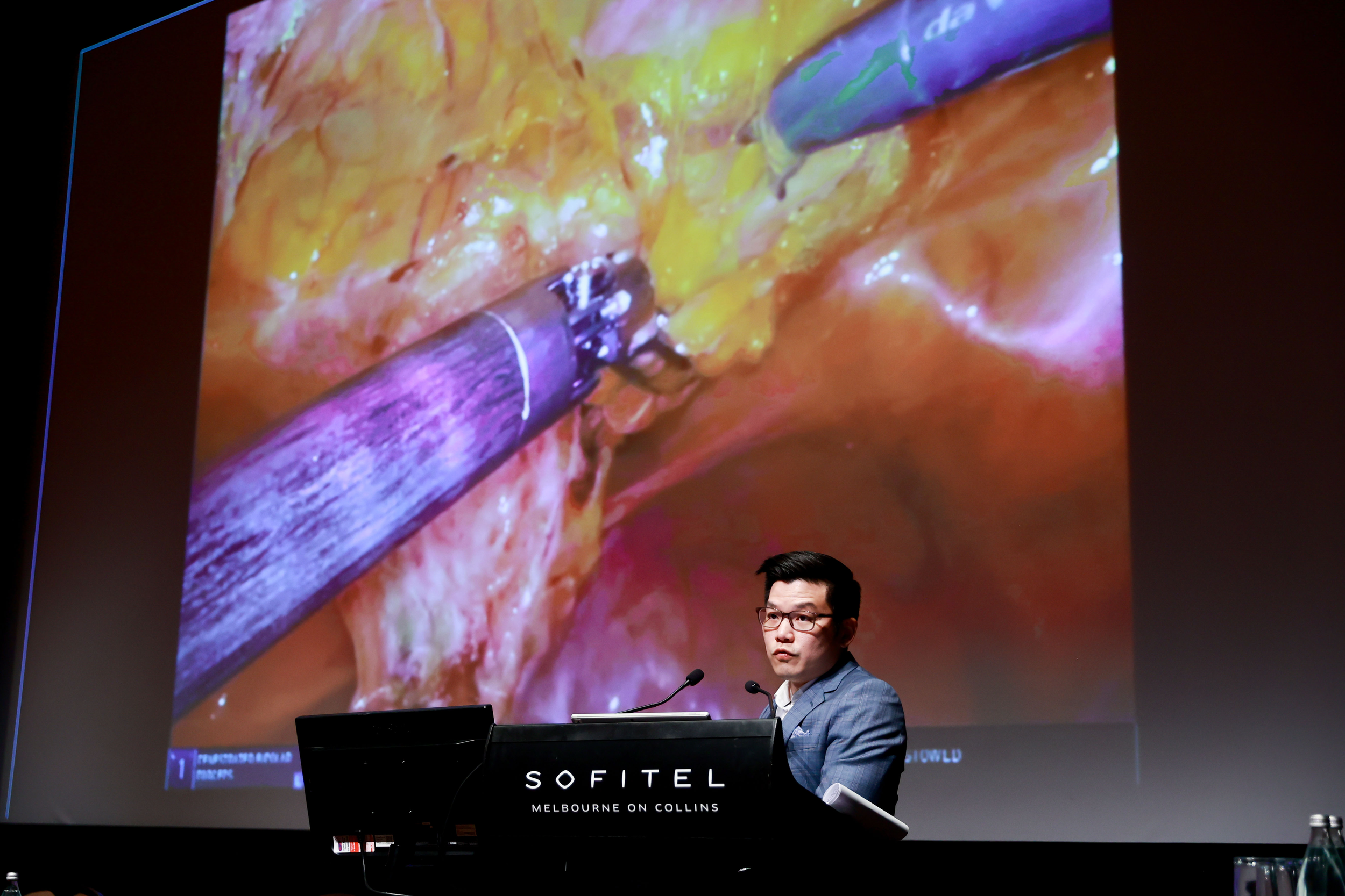 UGSA ASM presentation on robotic Burch colposuspension