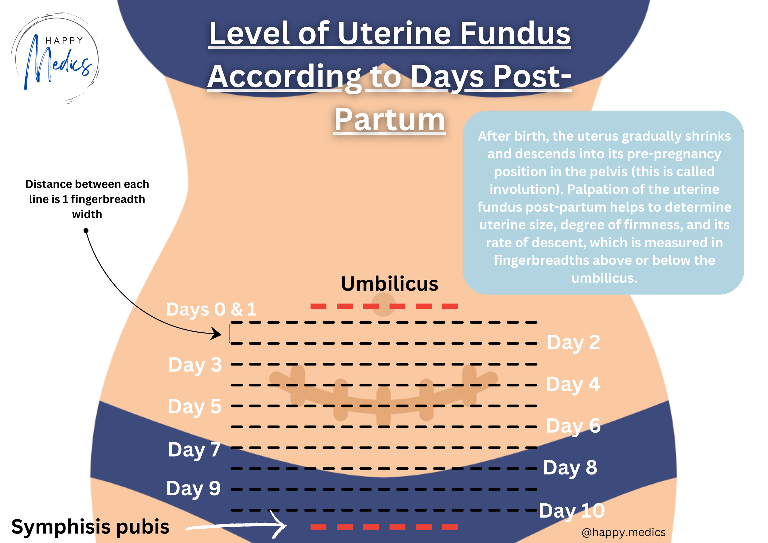 Junior Doctor Tips Assessing the PostCSection Patient — Happy Medics