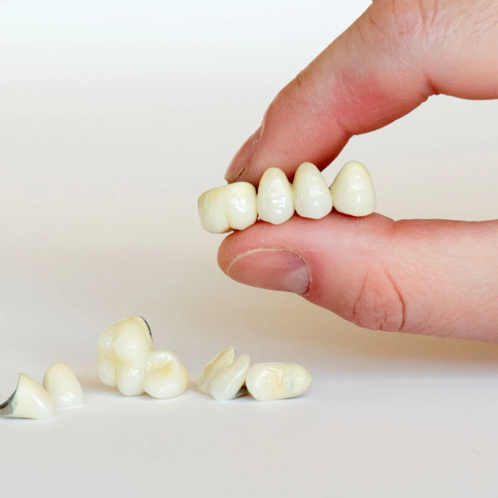 Dental Bridges in Merchiston Edinburgh at Ardmillan Dental Practice