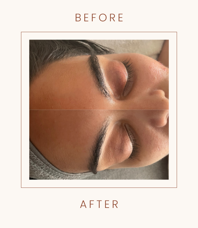 Before and after image showing eyebrow grooming with improvements to shape and fullness.
