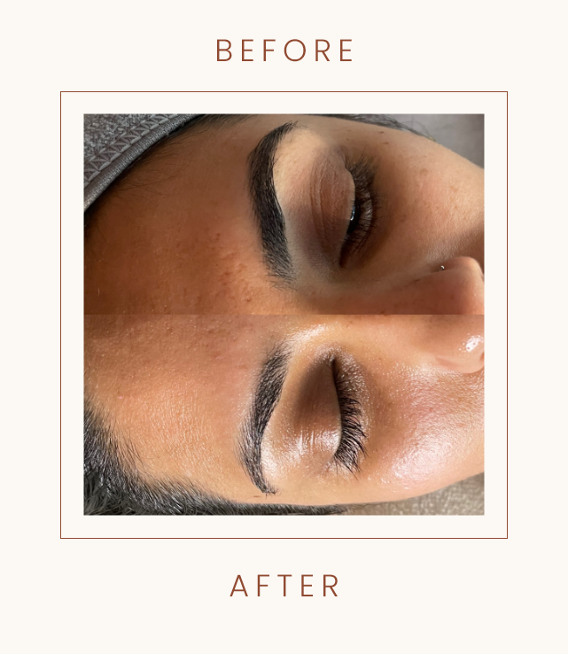 "Before and after photo showing eyebrow grooming."