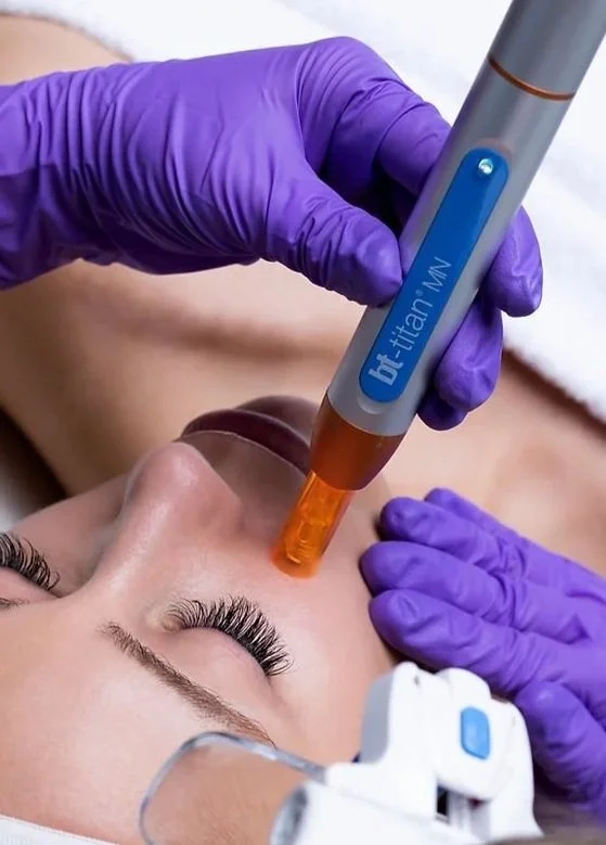 Person undergoing a facial treatment with bt-titan MN device and gloved hand.