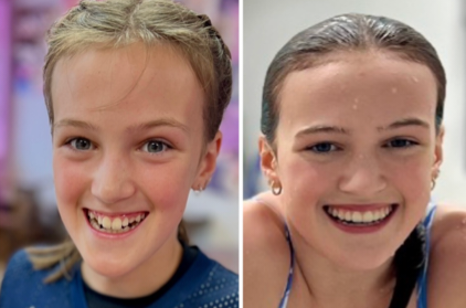INVISALIGN