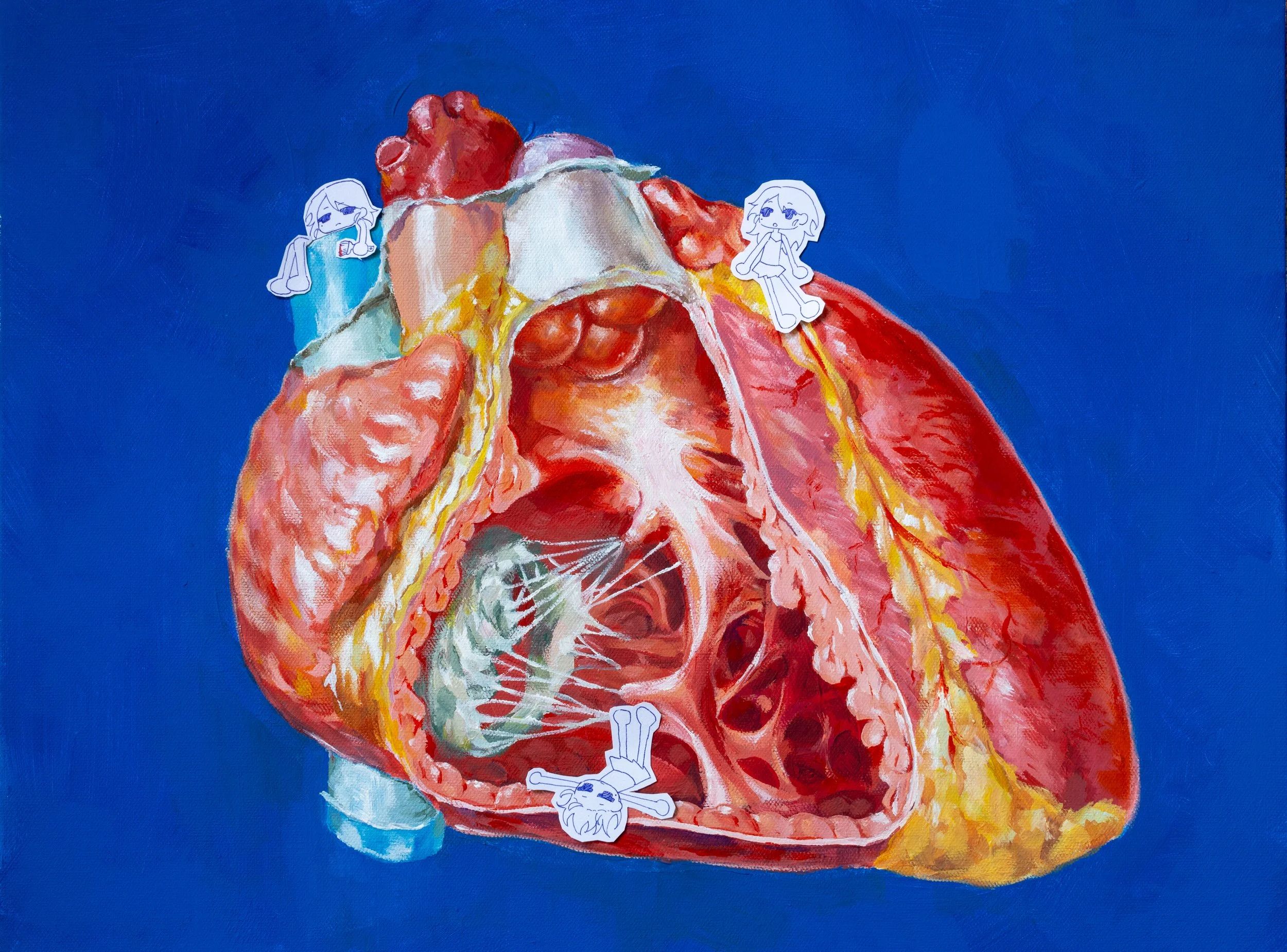 Open heart